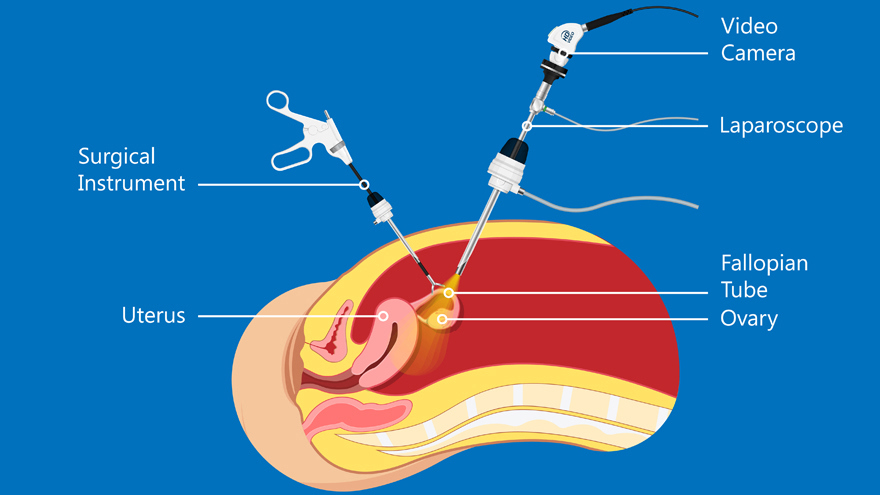 Transseksuallarda klitoris qanday osadi